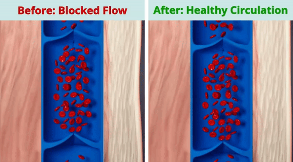 Blocked versus healthy circulation